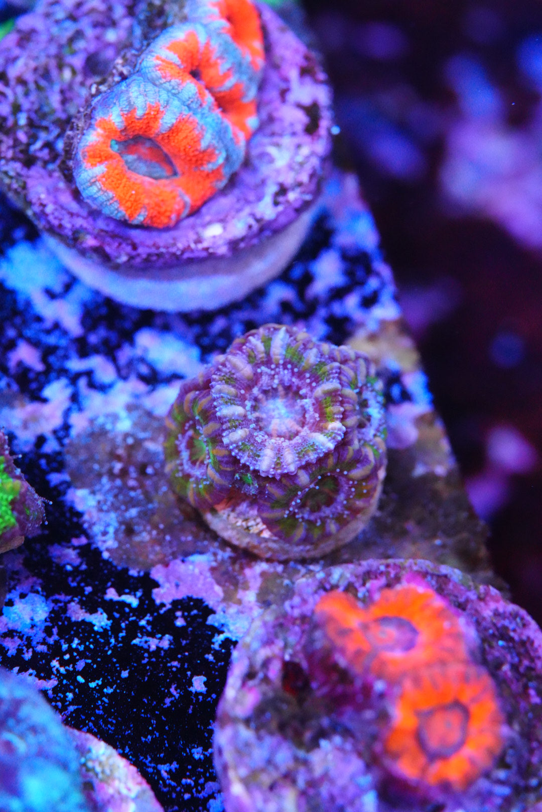 TMC cultured acan
